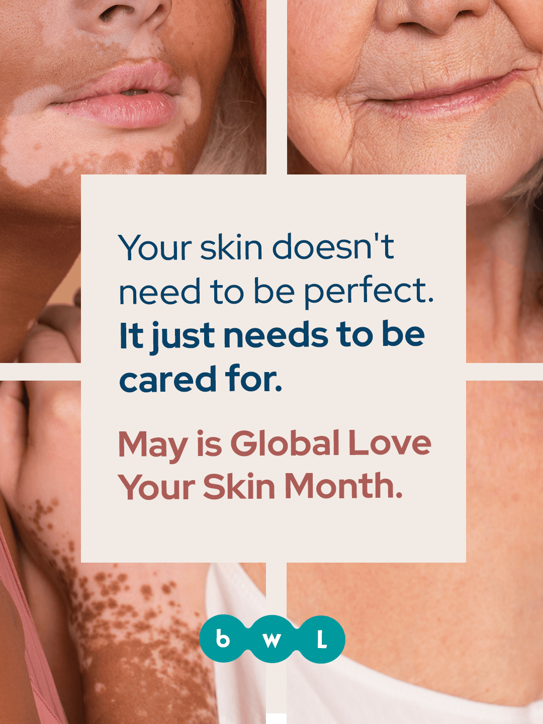 May 1 · Global Love Your Skin Month 1