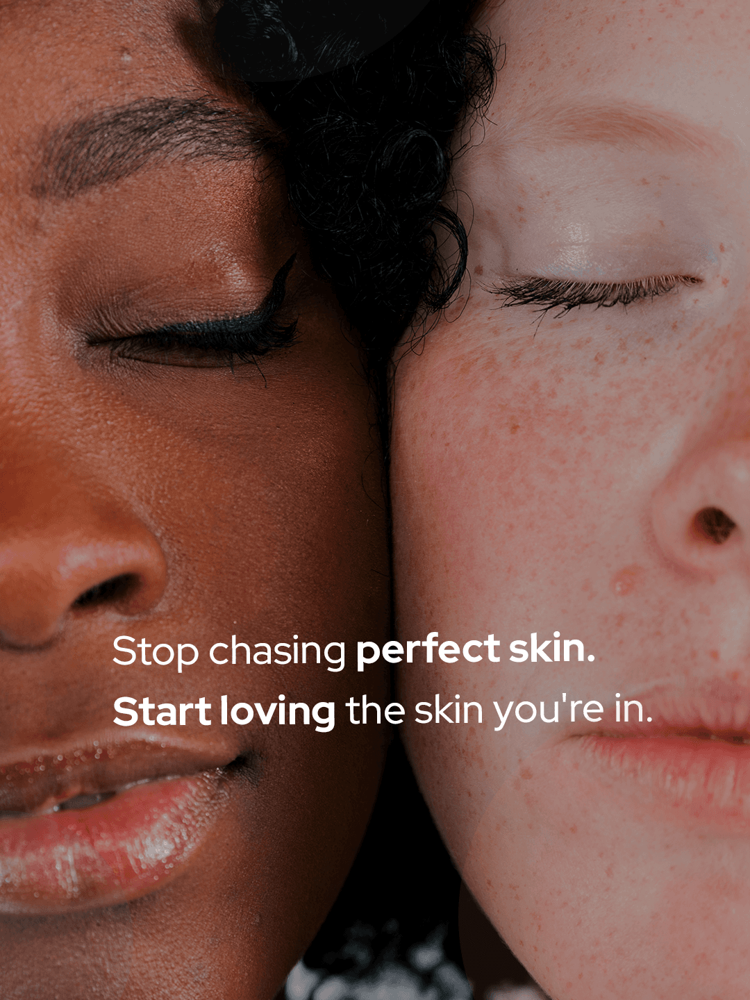 May 1 · Global Love Your Skin Month 3