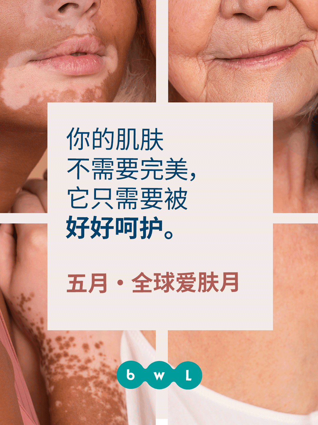 May 1 · Global Love Your Skin Month 1
