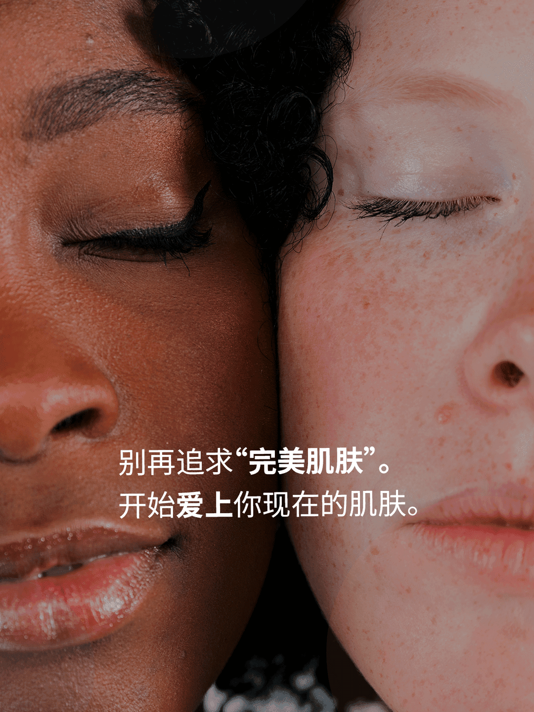 May 1 · Global Love Your Skin Month 3