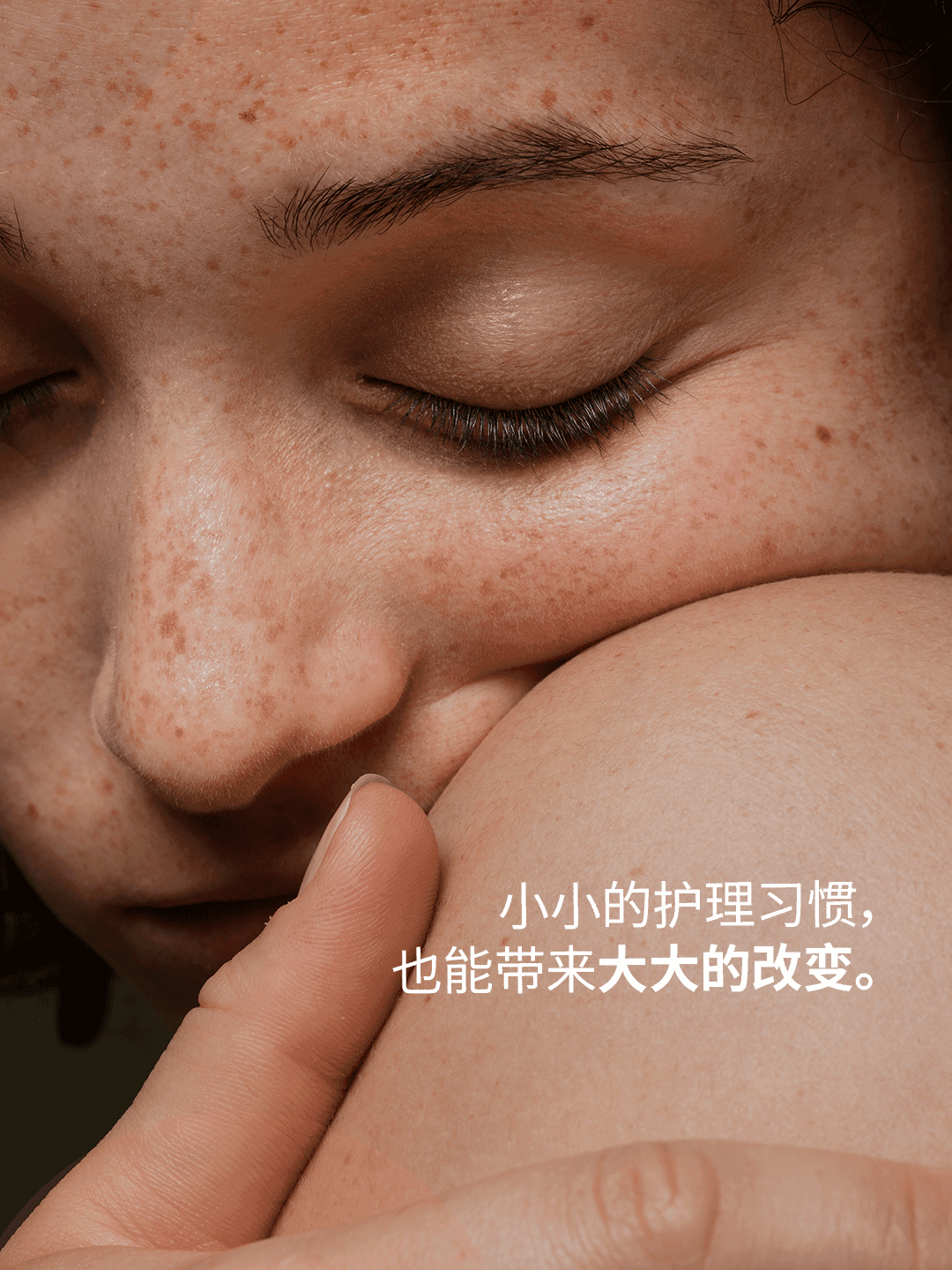 May 1 · Global Love Your Skin Month 4